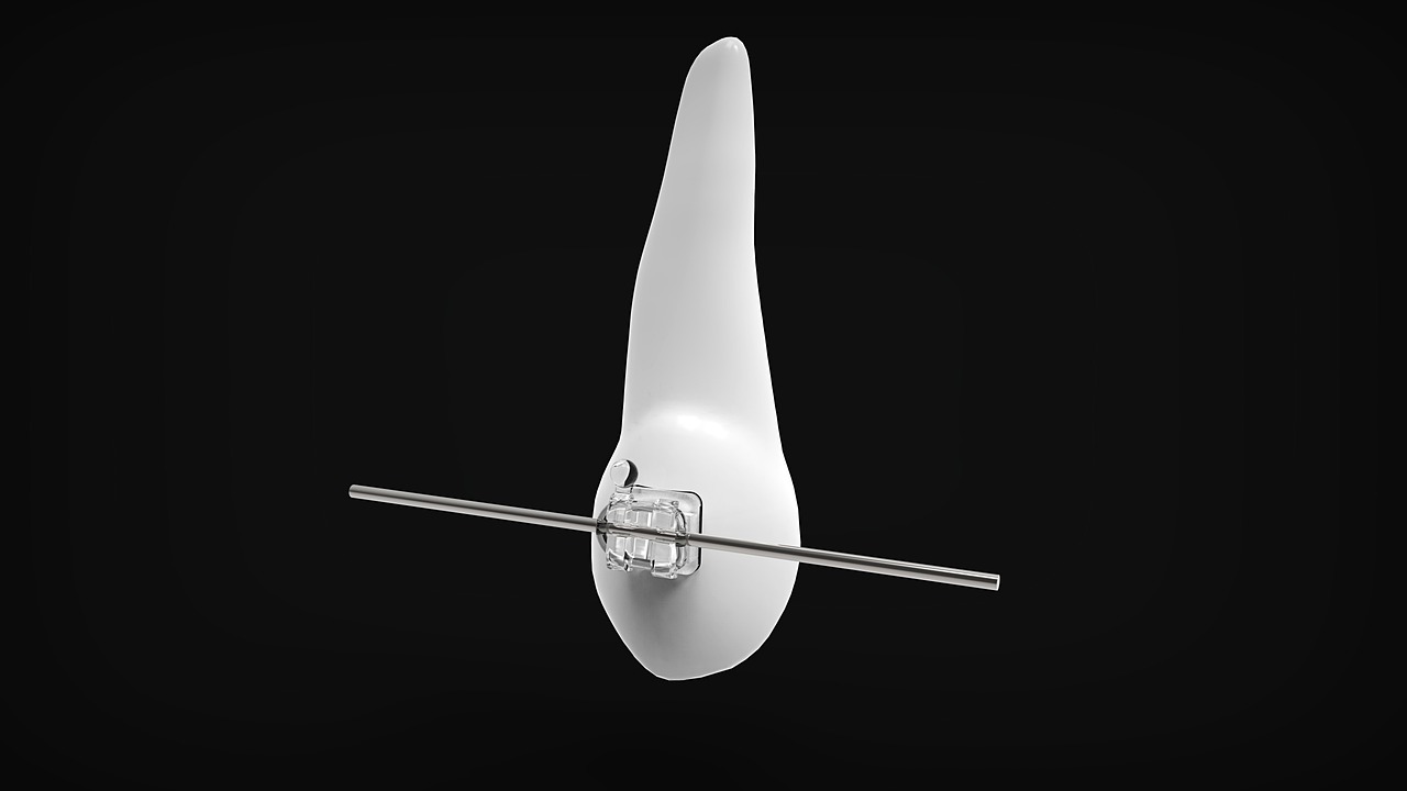 マウスピース矯正はワイヤーより安いのか？